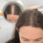 increase optical density man_edited_edited.jpg