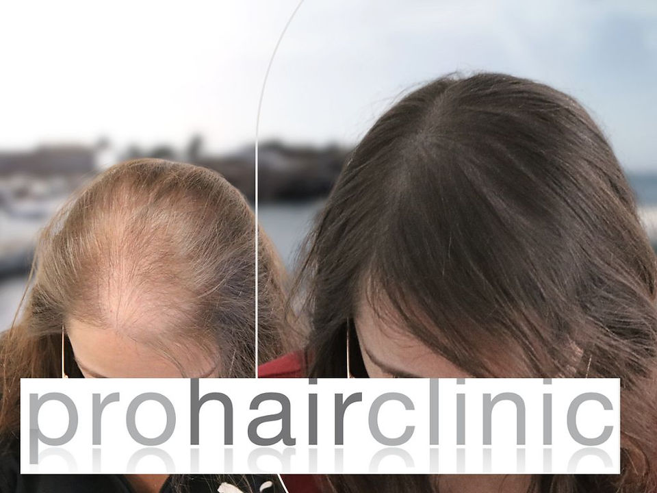 MHP Before and after photos