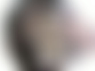 Digitale Haarmessung mittels Trichoskopie