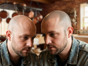 Mann vor und nach eine haarpigmentierung