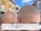 left hair pigmentation needle - right classic tattoo needle