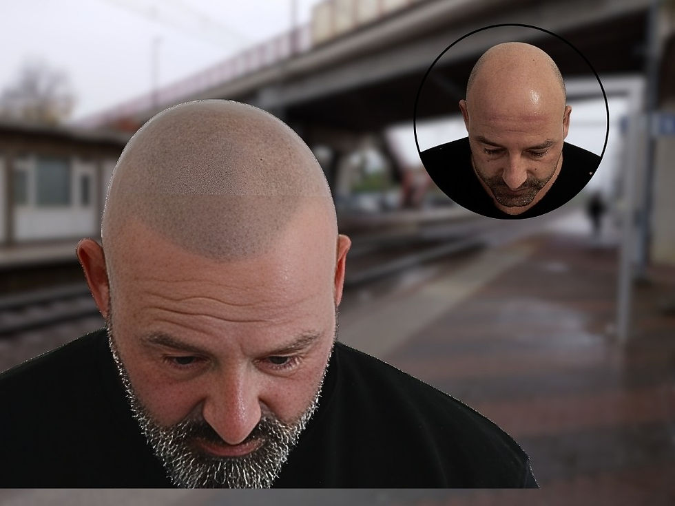 oorbeeld shaven look haarpigmentatie3.jpg