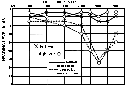 Audiogram.gif
