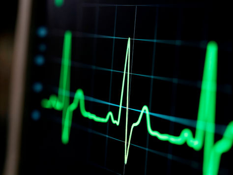 Ecocardiograma em Londrina: um olhar essencial para o seu coração