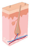 Laser Hair Removal Process