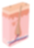 Laser Hair Removal Process