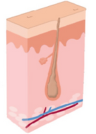 Laser Hair Removal Process
