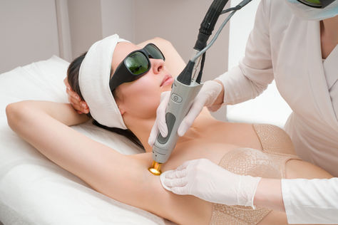 Laser Hair Removal Myths