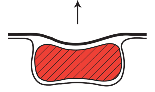 cartoon picture of a vacuum packaged product