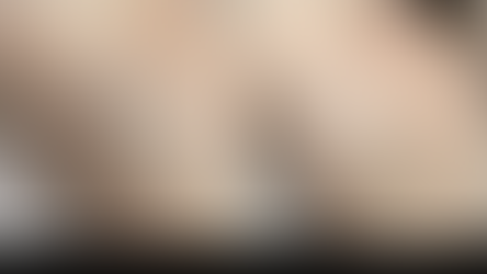 Before and after laser hair removal armpit