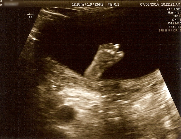 21 weeks-foot