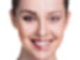 Medical Permanent Makeup