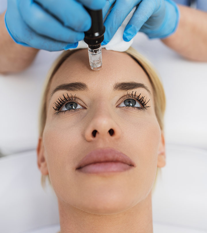 Micro Needling