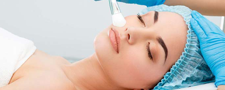 Chemical Peel