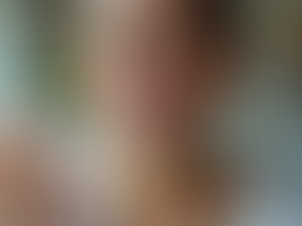 Achieve a Bright Smile with Professional Teeth Whitening Techniques