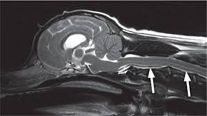 Syringomyelia in a dog (Picture courtesy)