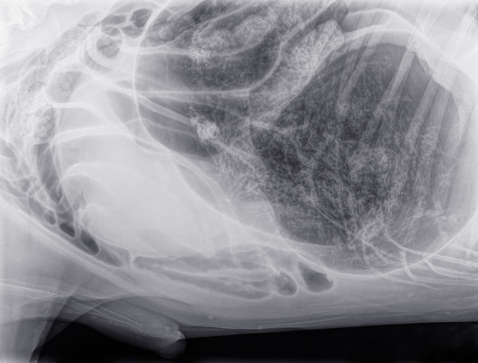 Abdominal x-ray