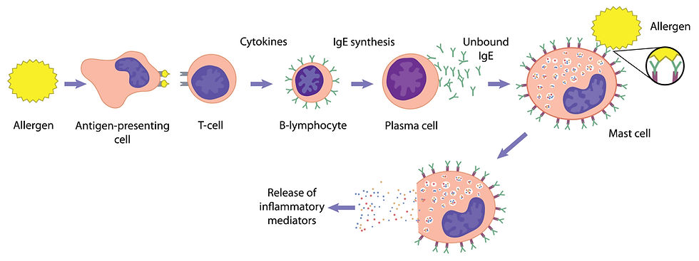 Allergic response. Sequence of events caused by an allergen resulting in the release of histamine and other inflammatory mediators.