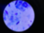 Microscopic view of Malassezia pachydermatis cells taken from a dog with ear infection.