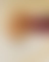 FIGOVE BLAZINICE (figovi settembrini)