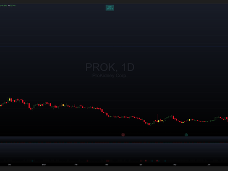 Trade Review - $PROK 7/9/25