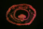 Earthworm Cross Section (20X Magnified)