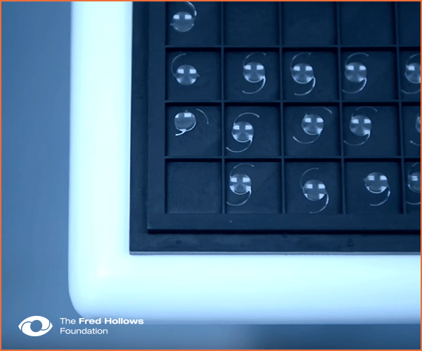FredHollows_Flipbook_concept4-GIF.gif