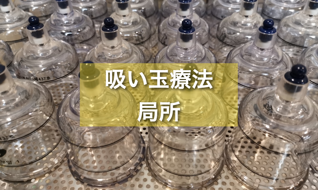 背部吸い玉療法(カッピング)の写真(岩手県八幡平市)