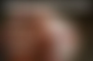 Leprosy in the Modern Believer