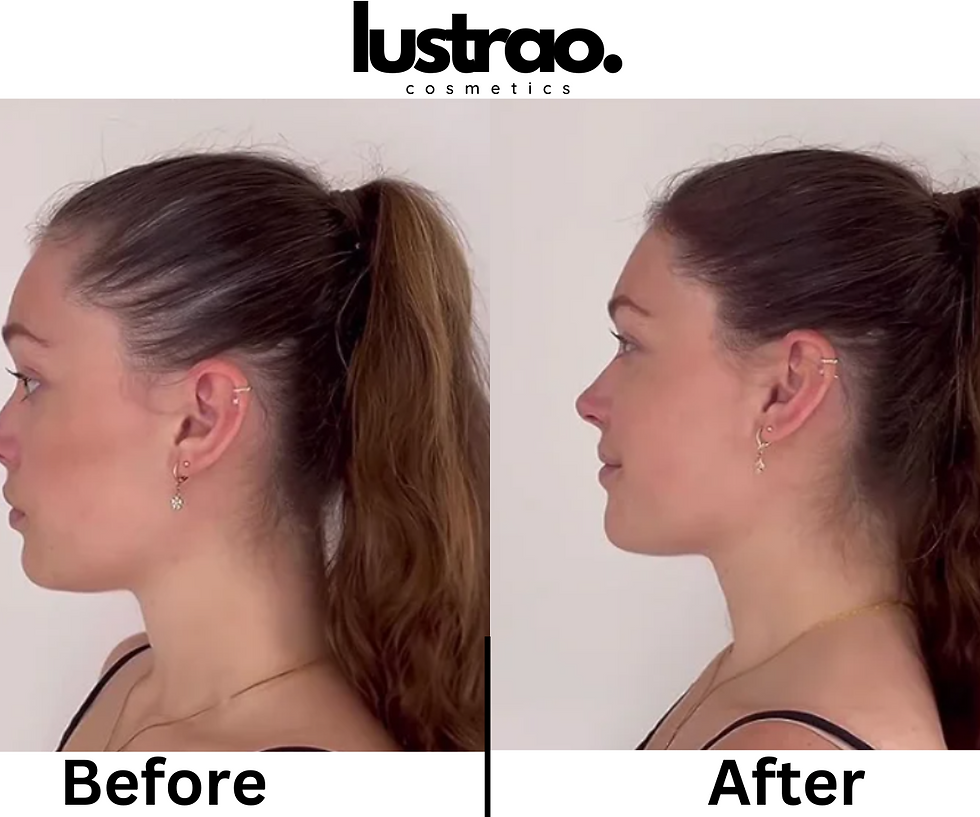 Thumbnail: Lustrao Huile Fortifiante Pousse des Cheveux