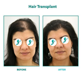 Luviacure Before After1.002.jpeg