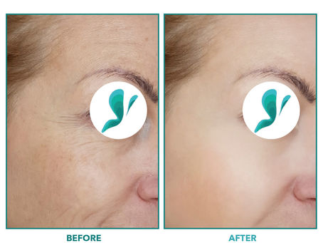 Surprising Benefits of Facelift Surgery You Didn't Know