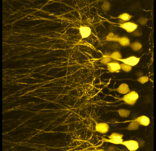 3D Neural Imaging