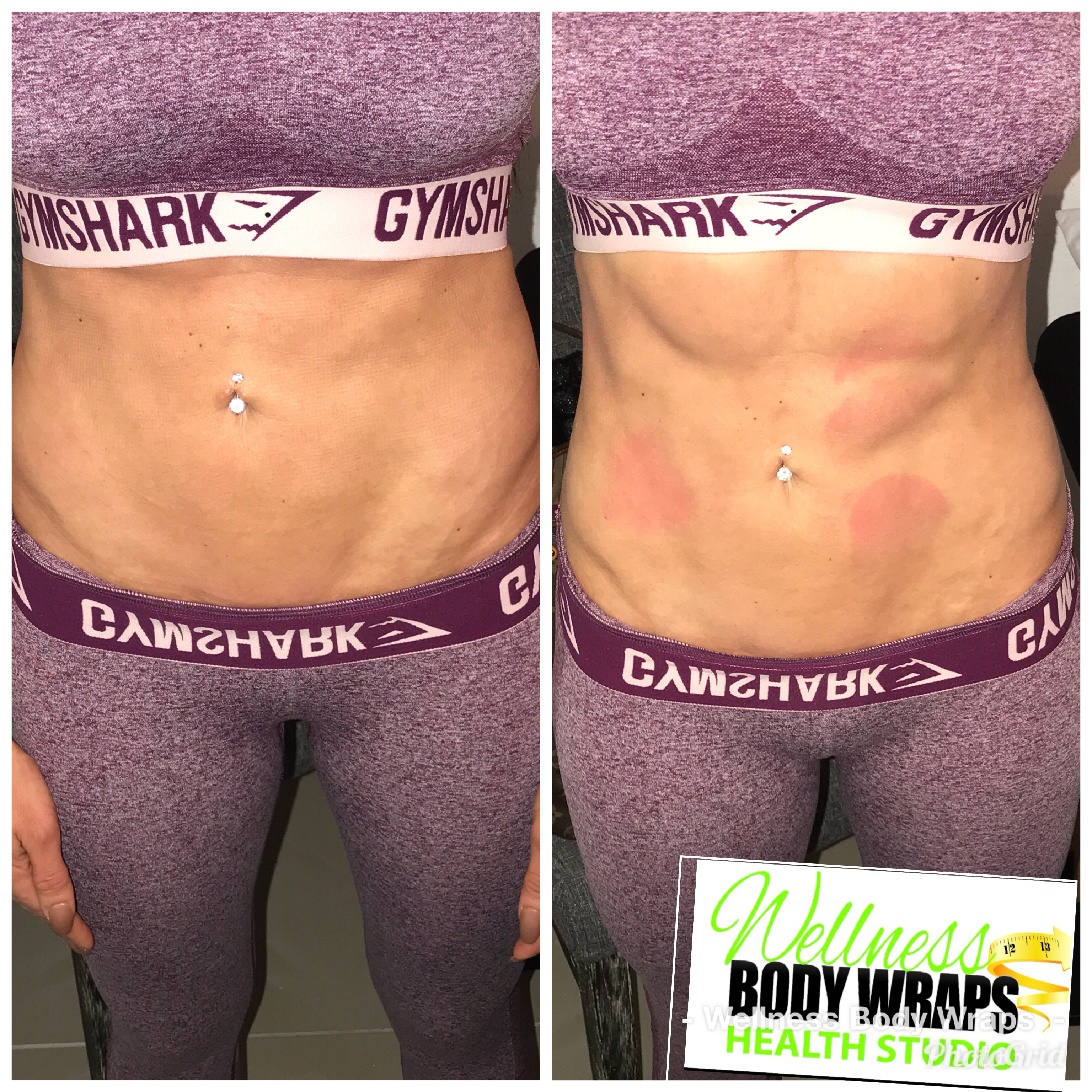 Wellness Weight Loss Infrared Wraps Vegas Weightloss Las Wellness Weight Loss Infrared Wraps Vegas Weightloss Las