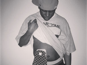 Ulcerative Colitis, Part 4: The Surgery