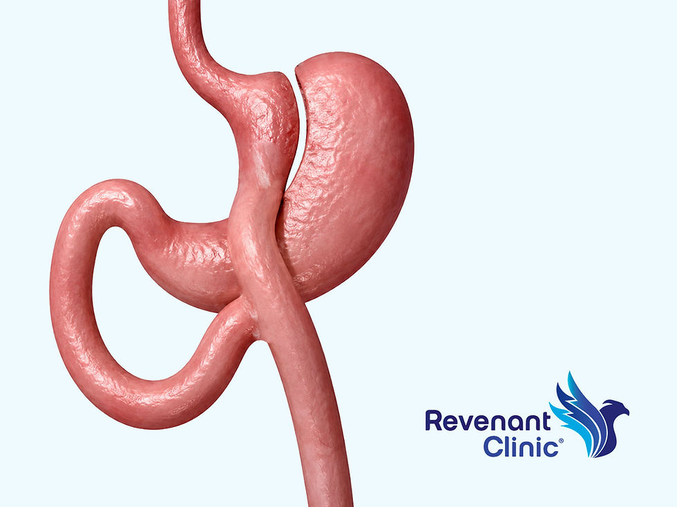 Mini Gastric Bypass: The Best of Two Bariatric Procedures?