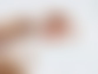 All-on-4 Implants: Complete Guide for Full Mouth Restoration
