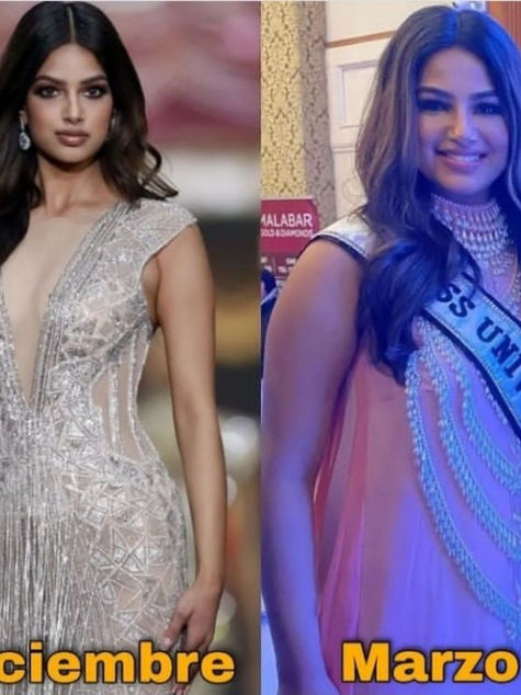 Miss Universo revela la enfermedad que padece tras ser criticada por su aumento de peso