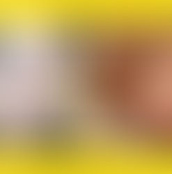 Los huesos faciales de esta actriz han empezado a 'pudrirse'