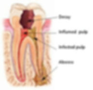 Allure DDS, Root Canals, Greenwich Village, New York City, NY 10003
