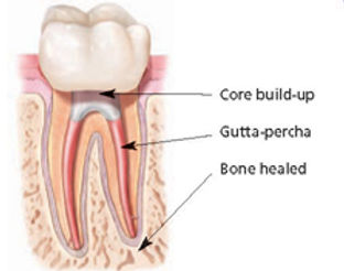 Allure DDS, Root Canals, Greenwich Village, New York City, NY 10003