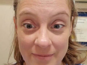 Facial Rejuvenation Acupuncture