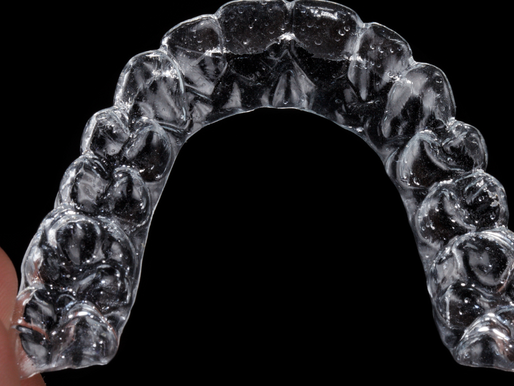 Invisalign: o tratamento discreto para alinhar os dentes