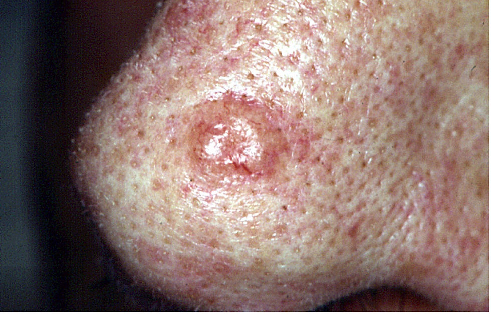 BCC nose.jpg