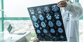 Traumatic Brain Injuries in Pennsylvania | Hourigan, Kluger & Quinn