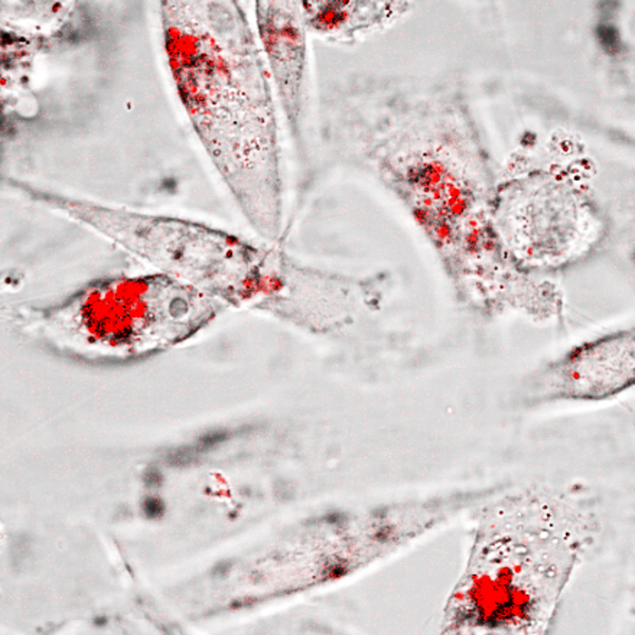 Gold nanoparticle aggregates (red) are observed inside triple negative breast cancer cells after an enzyme-activated assembly and internalization process. (photo credit: Richard Huang and Ye He) @ Richard Huang and Ye He