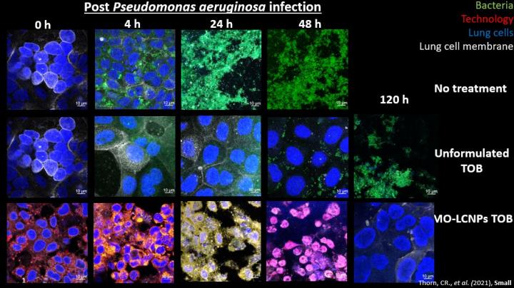 After four hours, if the infection is not treated it kills all the cells (line 1); Unformulated tobramycin keeps the cells alive, but it does not eradicate the infection (line 2); Nano-enhanced tobramycin eradicates the infection. @ UniSA