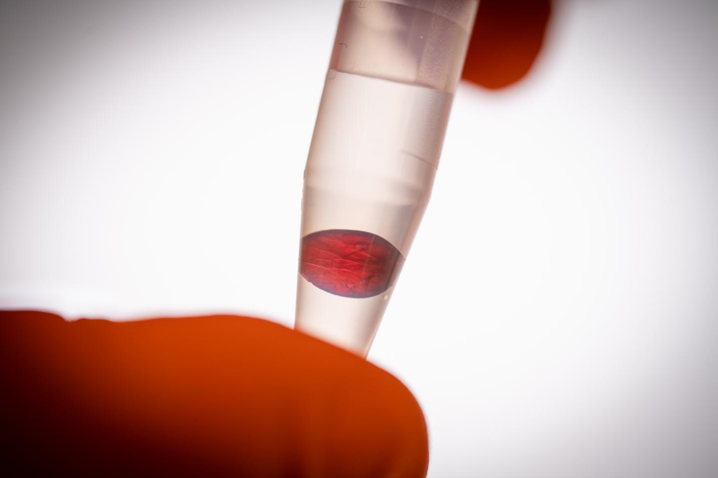 Nanocellulose decorated with metal nanoparticles. @ Magnus Johansson