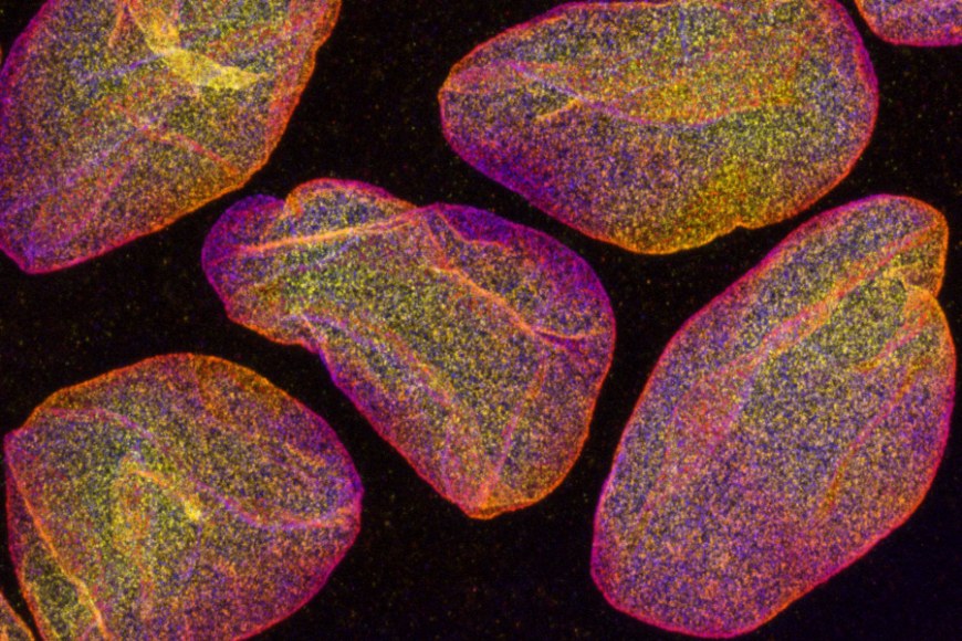 Fluorescently labelled cell nuclei, imaged with confocal microscope. Image size approximately 0.03 mm x 0.02 mm. @ Teemu Ihalainen