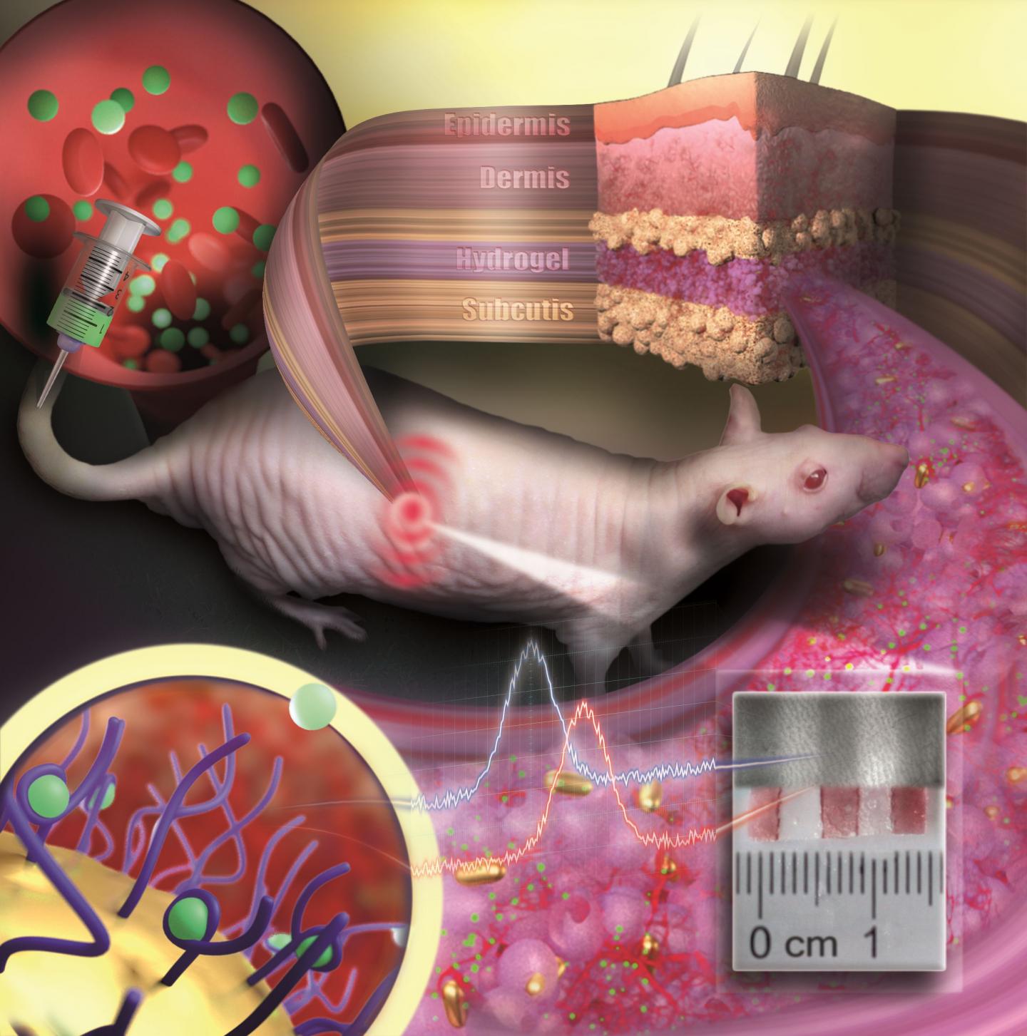 Gold nanoparticles embedded in a porous hydrogel can be implanted under the skin and used as medical sensors. The sensor is like an invisible tattoo revealing concentration changes of substances in the blood by color change. ©: Nanobiotechnology Group, JGU Department of Chemistry